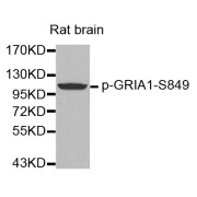 Western blot analysis of extracts from rat brain tissue using Phospho-GRIA1-S849 antibody (abx000294).