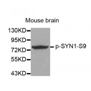 Western blot analysis of extracts from mouse Brain tissue using Phospho-SYN1-S9 antibody (abx000296).