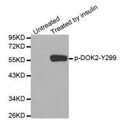 Western blot analysis of extracts from Jurkat cells using Phospho-DOK2-Y299 antibody (abx000302).