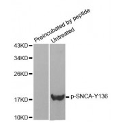 Western blot analysis of extracts from mouse brain tissue using Phospho-SNCA-Y136 antibody (abx000305) and the same antibody preincubated with blocking peptide.