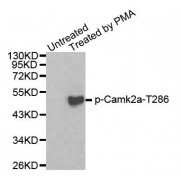 Western blot analysis of extracts from 293 cells using Phospho-Camk2a-T286 antibody (abx000306).