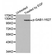 Western blot analysis of extracts from 293 cells using Phospho-GAB1-Y627 antibody (abx000307).