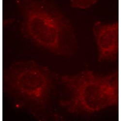 GAB1 (pY627) Antibody