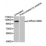 Western blot analysis of extracts from mouse brain tissue using Phospho-GRIA2-S880 antibody (abx000308) and the same antibody preincubated with blocking peptide.