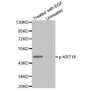 Western blot analysis of extracts from HT29 cells untreated or treated with EGF using Phospho-KRT18-S33 antibody (abx000314).