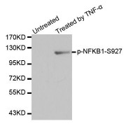 Western blot analysis of extracts from HL60 cells using Phospho-NFKB1-S927 antibody (abx000315).