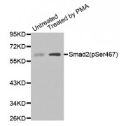 Western blot analysis of extracts of Untreated and treated 293T cell lines, using Phospho-SMAD2-S467 antibody (abx000320).