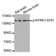 Western blot analysis of extracts from rat and mouse brain tissue using Phospho-NTRK1-S791 antibody (abx000323).
