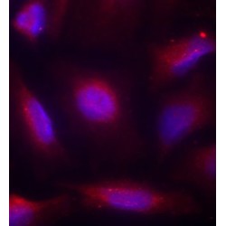 NTRK1 (pS791) Antibody