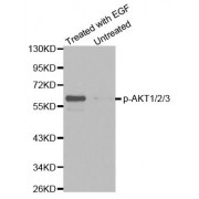 Western blot analysis of extracts from HepG2 cells untreated or treated with EGF using Phospho-AKT1-Y315/AKT2-Y316/AKT3-Y312 antibody (abx000325).