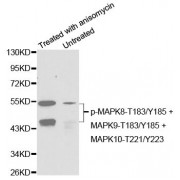 Western blot analysis of extracts from C6 cells untreated or treated with anisomycin using Phospho-MAPK8-T183/Y185 + MAPK9-T183/Y185 + MAPK10-T221/Y223 Antibody (abx000327).