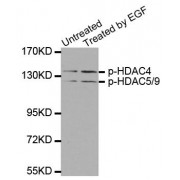 Western blot analysis of extracts from 293 cells untreated or treated with EGF using Phospho-HDAC4-S246/HDAC5-S259/HDAC9-S220 Antibody (abx000331).