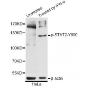 Western blot analysis of extracts of HeLa cells, using Phospho-STAT2-Y690 antibody (abx000335) at 1/2000 dilution. HeLa cells were treated by IFN-α (100ng/ml) for 30 minutes after serum-starvation overnight.