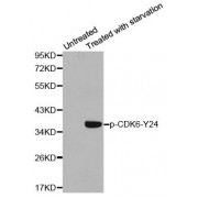 Western blot analysis of extracts from 293 cells using Phospho-CDK6-Y24 antibody (abx000340).
