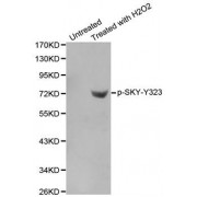 Western blot analysis of extracts from Jurkat cells using phospho-SYK-Y323 antibody (abx000342).