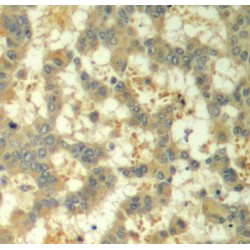 Spleen Associated Tyrosine Kinase Phospho-Tyr323 (SYK pY323) Antibody