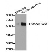 Western blot analysis of extracts from HeLa cells using Phospho-SMAD1-S206 antibody (abx000346).