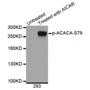 Western blot analysis of extracts from 293 cells using Phospho-ACACA-S79 antibody (abx000349).