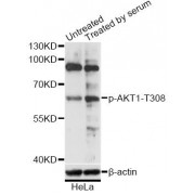 Western blot analysis of extracts of HeLa cells, using Phospho-AKT1-T308 antibody (abx000352) at 1/2000 dilution. HeLa cells were treated by 10% FBS for after serum-starvation overnight.