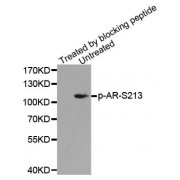 Western blot analysis of extracts from DU145 cells using Phospho-AR-S213 antibody (abx000354).
