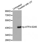 Western blot analysis of extracts from HeLa cells using Phospho-ATF4-S245 antibody (abx000357).