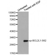 Western blot analysis of extracts from HeLa cells using Phospho-BCL2L1-S62 antibody (abx000362).