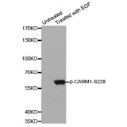 Western blot analysis of extracts from A431 cells using Phospho-CARM1-S228 antibody (abx000367).