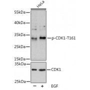 Western blot analysis of extracts of HeLa cells, using CDK1 pT161 antibody (1/2000 dilution). HeLa cells were treated by EGF (100 ng/ml) for 30 minutes after serum-starvation overnight.