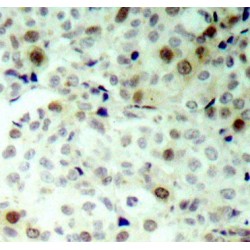 CDK2 (pT160) Antibody