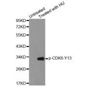 Western blot analysis of extracts from 293 cells using Phospho-CDK6-Y13 antibody (abx000374).