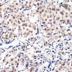 CDKN1B (pT187) Antibody