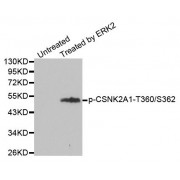 Western blot analysis of extracts from 293 cells, using Phospho-CSNK2A1-T360/S362 antibody (abx000383).