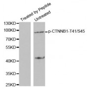 Western blot analysis of extracts from SW626 cells using Phospho-CTNNB1-T41/S45 antibody (abx000384).