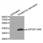 Western blot analysis of extracts from HeLa cells, using phospho-EIF2S1-S49 antibody (abx000389).