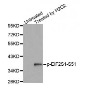 Western blot analysis of extracts from Jurkat cells, using Phospho-EIF2S1-S51 antibody (abx000390).