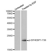 Western blot analysis of extracts from MDA-MB-435 cells, using Phospho-EIF4EBP1-T36 antibody (abx000392).