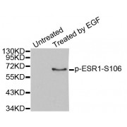 Western blot analysis of extracts from MCF7 cells, using Phospho-ESR1-S106 antibody (abx000395).
