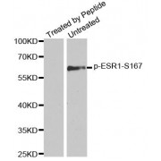 Western blot analysis of extracts from MCF7 cells using Phospho-ESR1-S167 antibody (abx000396).