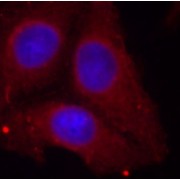 Immunofluorescence staining of methanol-fixed HeLa cells using Phospho-GAP43-S41 antibody (abx000401).