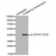 Western blot analysis of extracts from HT29 cells, using Phospho-GATA1-S310 antibody (abx000402).