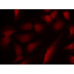GATA1 (pS310) Antibody