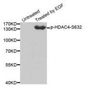 Western blot analysis of extracts from 293 cells using Phospho-HDAC4-S632 antibody (abx000407).
