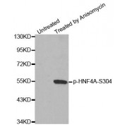 Western blot analysis of extracts from HeLa cells, using Phospho-HNF4A-S304 antibody (abx000410).