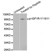 Western blot analysis of extracts from 293 cells, using Phospho-IGF1R-Y1161 antibody (abx000415).