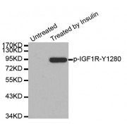 Western blot analysis of extract from 293 cells, using Phospho-IGF1R-Y1280 antibody (abx000416).