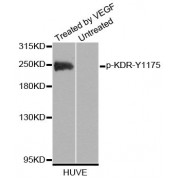 Western blot analysis of extracts of HUVE cells, using Phospho-KDR-Y1175 antibody (abx000430).
