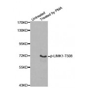 Western blot analysis of extracts from HeLa cells, using Phospho-LIMK1-T508 antibody (abx000434).