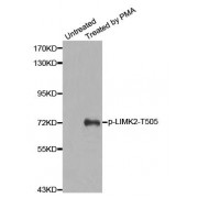 Western blot analysis of extracts from HeLa cells, using Phospho-LIMK2-T505 antibody (abx000435).