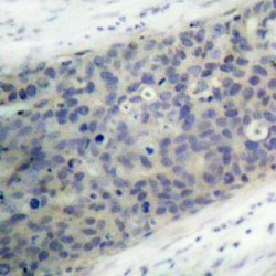 LIMK2 (pT505) Antibody