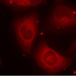 LIMK2 (pT505) Antibody